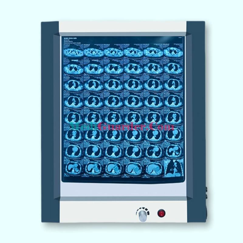 LED Ultra-thin Film Viewer, X-ray Film Viewer