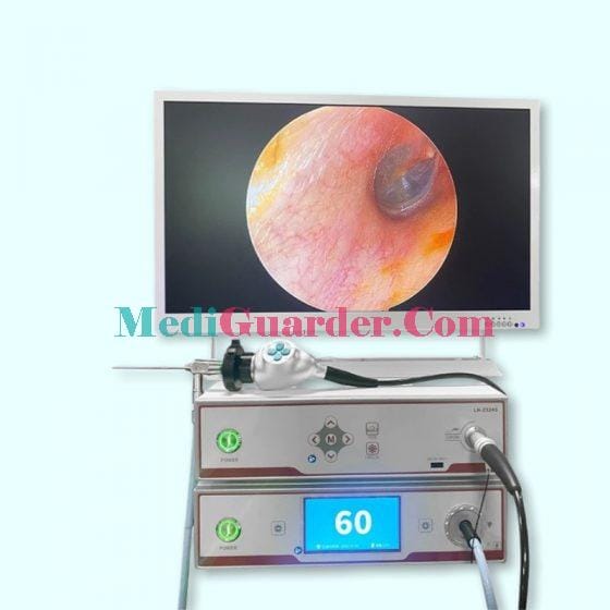 High-Definition Imaging System of Otolaryngology Endoscope