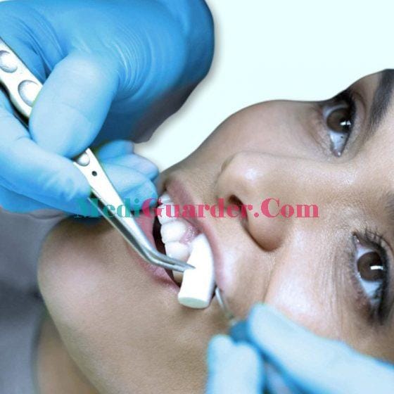 Medical Disposable Dental Hemostatic Cotton Roll